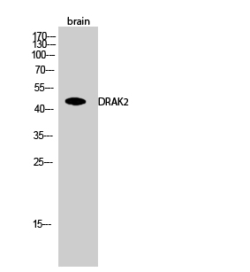 Western Blot analysis of brain cells using DRAK2 Polyclonal Antibody cells nucleus extracted by Minute TM Cytoplasmic and Nuclear Fractionation kit 