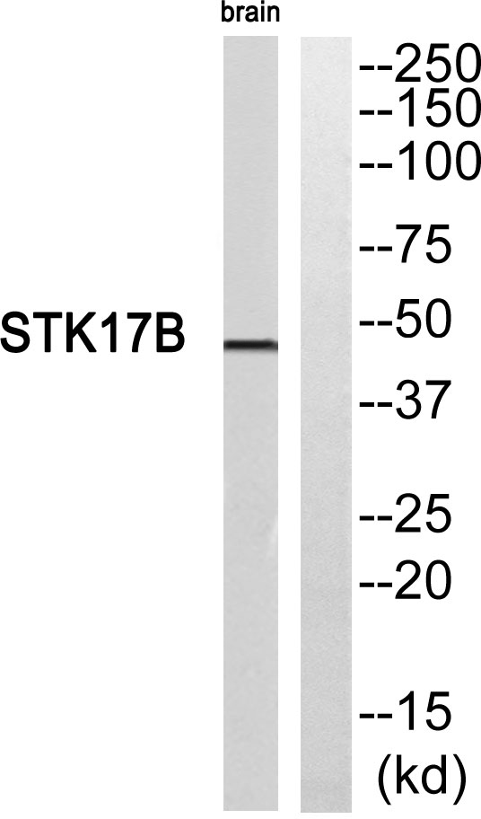 Western blot analysis of STK17B Antibody