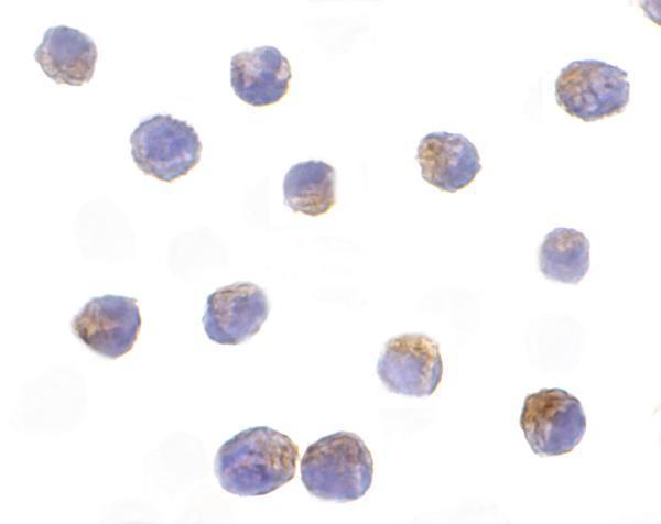 Immunocytochemistry of DRAK2 in Jurkat cells with DRAK2 antibody at 10 μg/mL