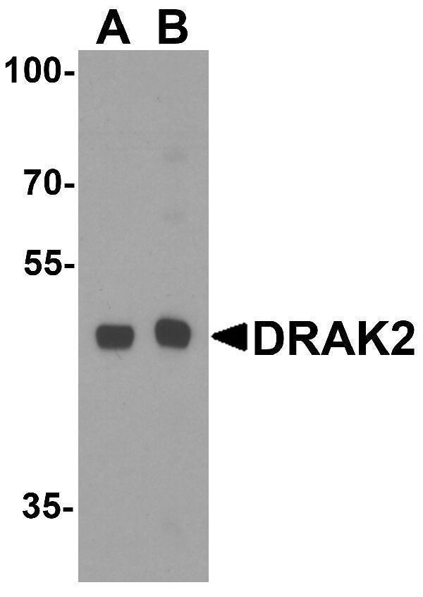 Western blot analysis of DRAK2 in Raji cell lysate with DRAK2 antibody at (A) 1 and B (2) μg/mL