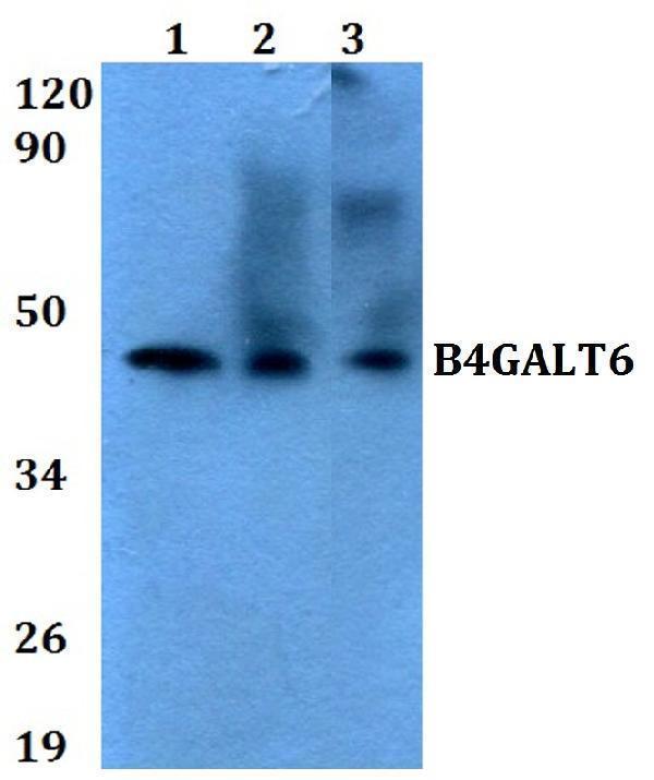 Western blot (WB) analysis of B4GALT6 polyclonal antibody at 1:500 dilution
Lane1:HEK293T whole cell lysate
Lane2:A549 whole cell lysate 
Lane3:sp2/0 whole cell lysate 