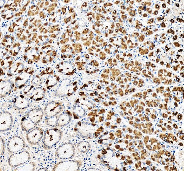 IHC analysis of ATP4B using anti-ATP4B antibody (A08719-2)