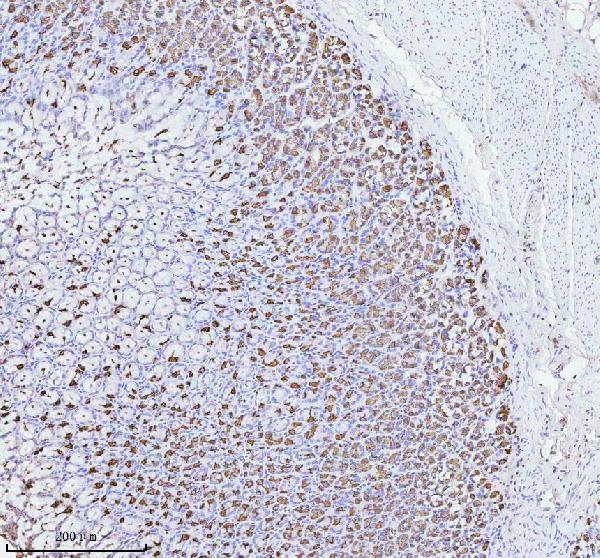 a08719 2 atp4b primary antibodies ihc testing 4