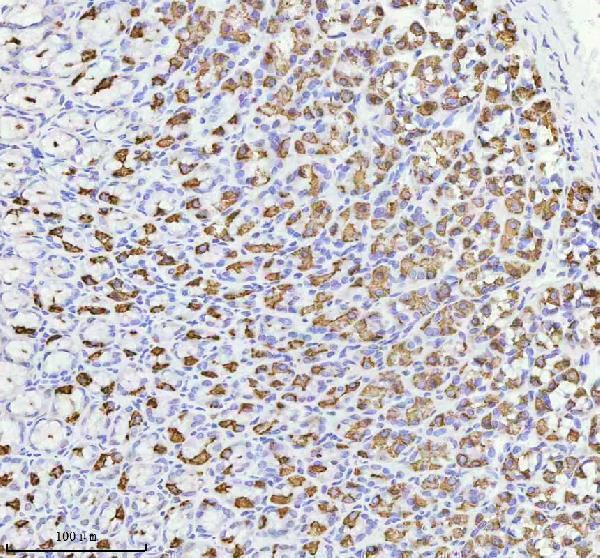 a08719 2 atp4b primary antibodies ihc testing 5