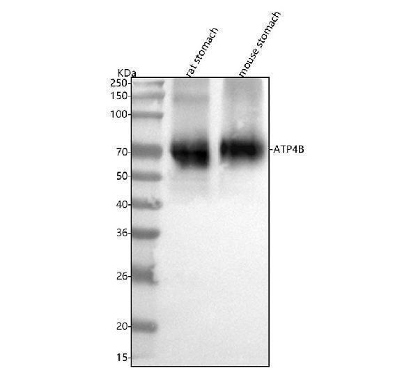  Western blot analysis of ATP4B using anti-ATP4B antibody (A08719-2)