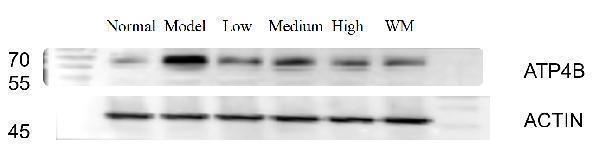  Western blot analysis of ATP4B using anti-ATP4B antibody (A08719-2)