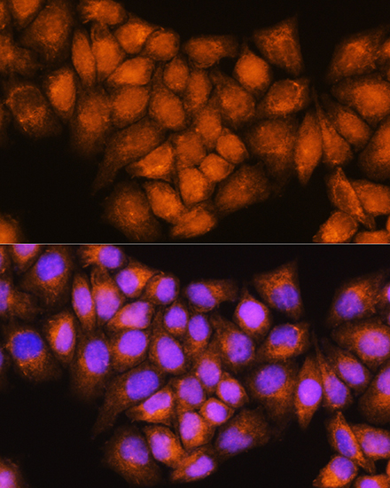 Immunofluorescence analysis of HeLa cells using ARCN1 Rabbit pAb  at dilution of 1:100