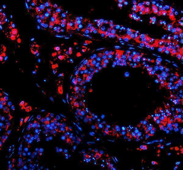 a08728 1 pex5l primary antibodies if testing 1