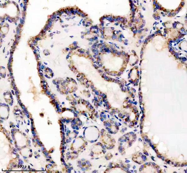 a08728 1 pex5l primary antibodies ihc testing 1