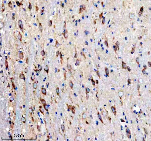 a08728 1 pex5l primary antibodies ihc testing 4