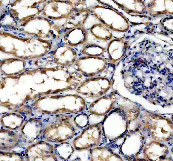 IHC analysis of SLC25A11 using anti-SLC25A11 antibody (A08732-2)