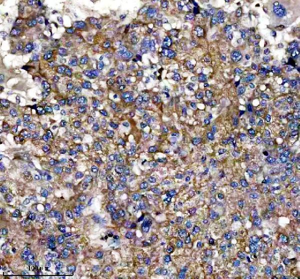 IHC analysis of SLC25A11 using anti-SLC25A11 antibody (A08732-2)