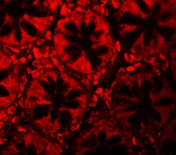 Immunofluorescence of LRRFIP2 in human colon tissue with LRRFIP2 antibody at 20 μg/mL