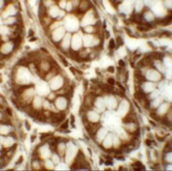 Immunohistochemistry of LRRFIP2 in human colon tissue with LRRFIP2 antibody at 5 μg/mL