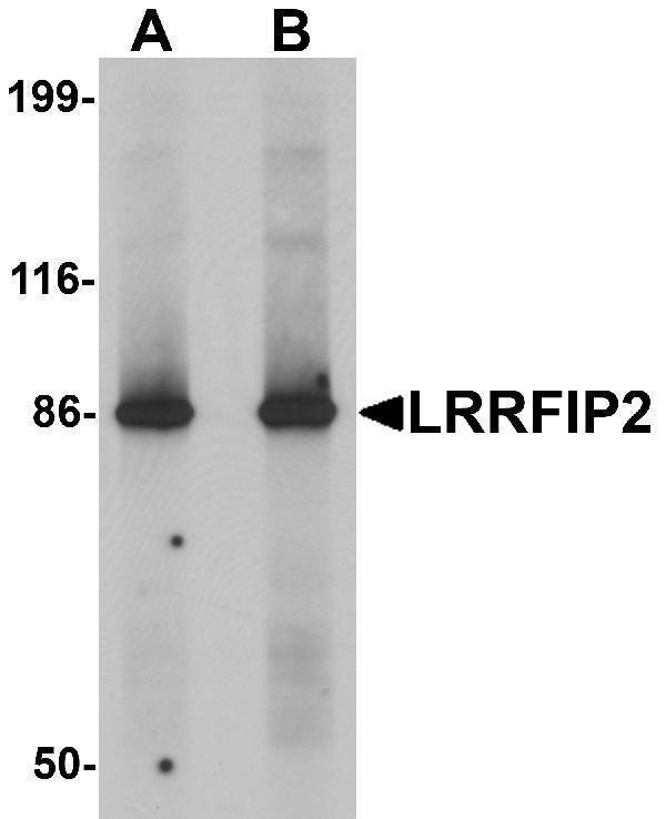 Western blot analysis of LRRFIP2 in rat colon tissue lysate with LRRFIP2 antibody at (A) 0