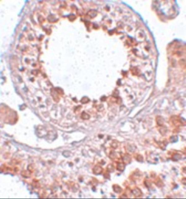 Immunohistochemistry of ESX1 in human testis tissue with ESX1 antibody at 2