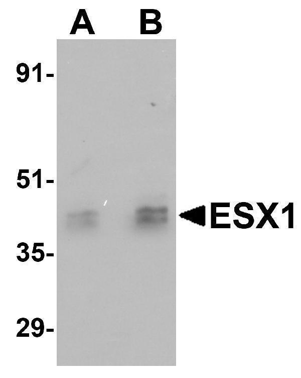Western blot analysis of ESX1 in human testis tissue lysate with ESX1 antibody at (A) 1 and (B) 2 μg/mL