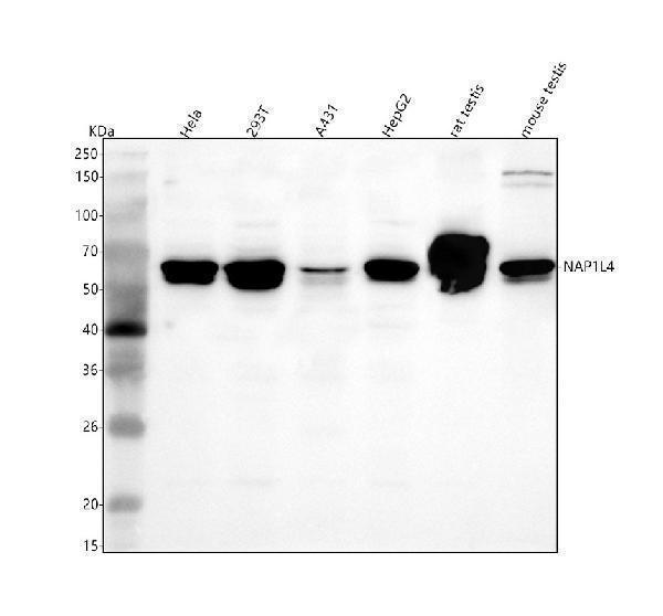 Western blot analysis of NAP1L4 using anti-NAP1L4 antibody (A08739-1)
