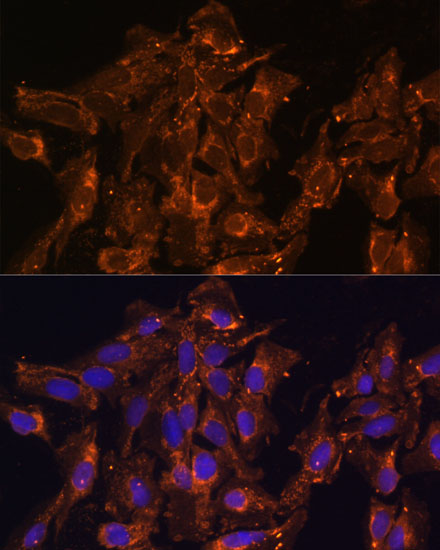 Immunofluorescence analysis of U-2 OS cells using HSD17B8 Polyclonal Antibody  at dilution of 1:100 