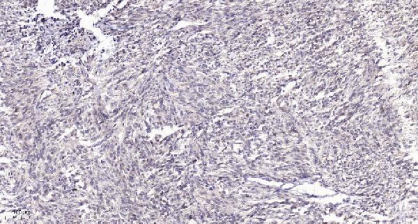 a08745 1 foxl1 primary antibodies ihc testing 1