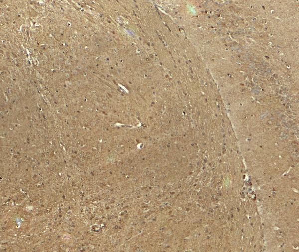 a08747 cadm3 primary antibodies ihc testing 2
