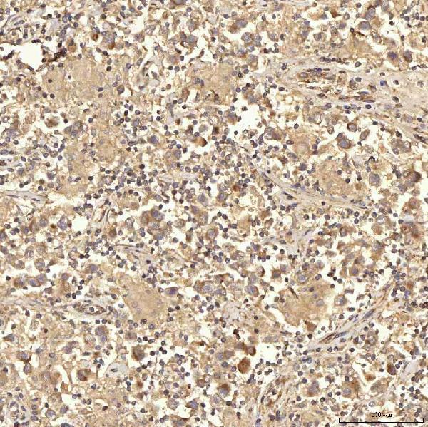 a08752 2 rbms1 primary antibodies ihc testing 10