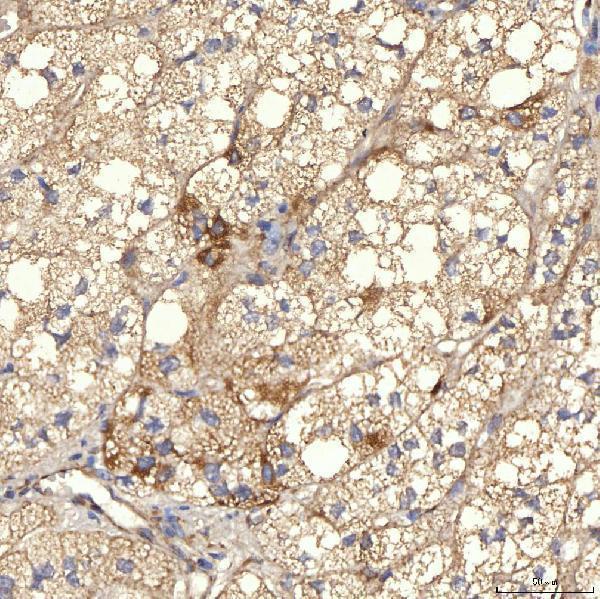 a08752 2 rbms1 primary antibodies ihc testing 2