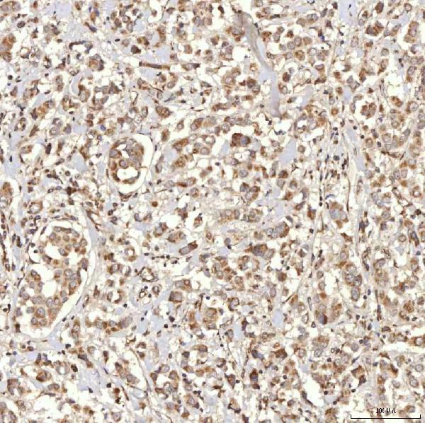 a08752 2 rbms1 primary antibodies ihc testing 3