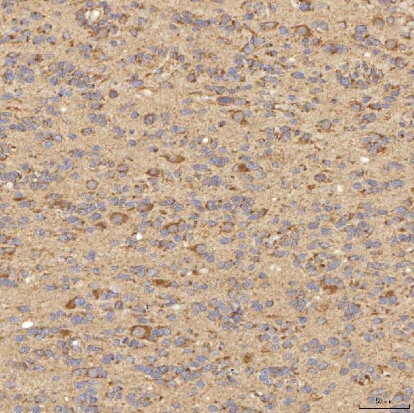 a08752 2 rbms1 primary antibodies ihc testing 4
