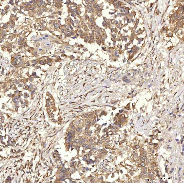 a08752 2 rbms1 primary antibodies ihc testing 5
