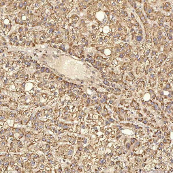 a08752 2 rbms1 primary antibodies ihc testing 6