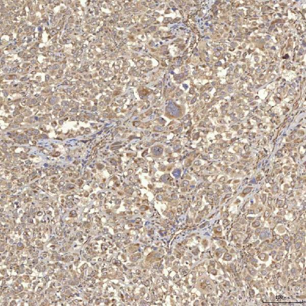 a08752 2 rbms1 primary antibodies ihc testing 7