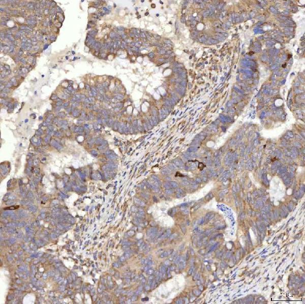 a08752 2 rbms1 primary antibodies ihc testing 8