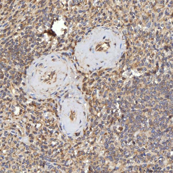 a08752 2 rbms1 primary antibodies ihc testing 9