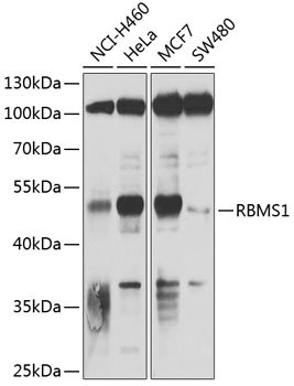 a08752 rbms1 primary antiboties wb testing 1