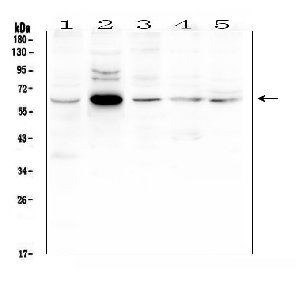 Western blot analysis of EGFL6 using anti-EGFL6 antibody (A08756). Electrophoresis was performed on a 5-20% SDS-PAGE gel at 70V (Stacking gel) / 90V (Resolving gel) for 2-3 hours. The sample well of each lane was loaded with 50ug of sample under reducing conditions. Lane 1: rat liver tissue lysates, Lane 2: mouse thymus tissue lysates, Lane 3: mouse lung tissue lysates, Lane 4: mouse liver tissue lysates, Lane 5: mouse SP20 whole cell lysates. After Electrophoresis, proteins were transferred to a Nitrocellulose membrane at 150mA for 50-90 minutes. Blocked the membrane with 5% Non-fat Milk/ TBS for 1.5 hour at RT. The membrane was incubated with rabbit anti-EGFL6 antigen affinity purified polyclonal antibody (Catalog # A08756) at 0.5 μg/mL overnight at 4°C, then washed with TBS-0.1%Tween 3 times with 5 minutes each and probed with a goat anti-rabbit IgG-HRP secondary antibody at a dilution of 1:10000 for 1.5 hour at RT. The signal is developed using an Enhanced Chemiluminescent detection (ECL) kit (Catalog # EK1002) with Tanon 5200 system. A specific band was detected for EGFL6 at approximately 62KD. The expected band size for EGFL6 is at 62KD.