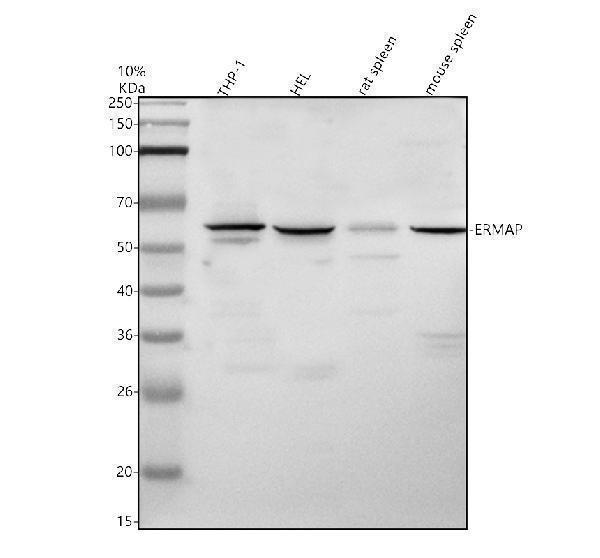 Western blot analysis of ERMAP using anti-ERMAP antibody (A08759-1)
