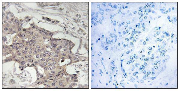 a08760 1 hibadh primary antibodies ihc testing 1
