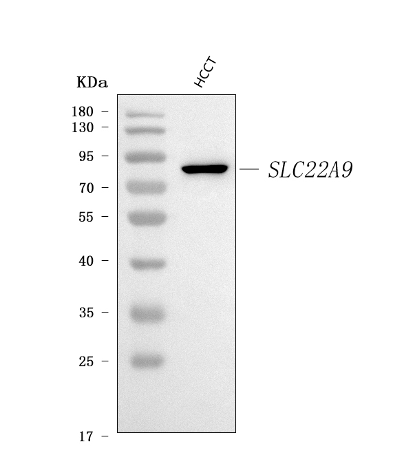  Western blot analysis of SLC22A9 using anti-SLC22A9 antibody (A08762-1)