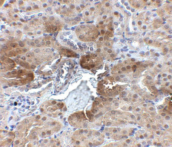 a08763 pter primary antibodies ihc testing 2