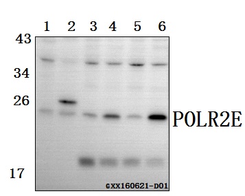 a08765 polr2e primary antiboties wb testing 1