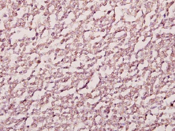 Immunohistochemistry (IHC) analyzes of Emp (E207) pAb in paraffin-embedded human tonsil cancer tissue at 1:50