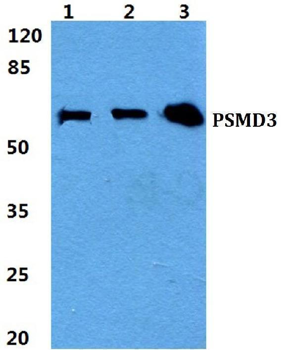 Western blot (WB) analysis of PSMD3 polyclonal antibody at 1:500 dilution
Lane1:HEK293T cell lysate
Lane2:Raw264