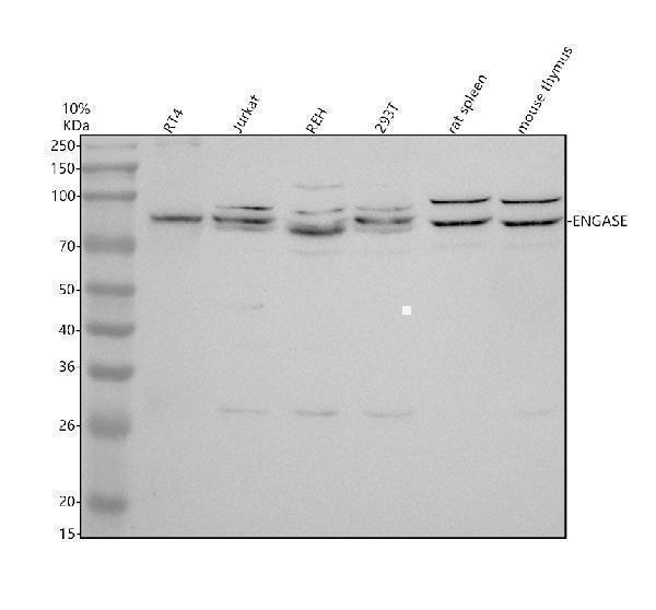 Western blot analysis of ENGASE using anti-ENGASE antibody (A08768-1)