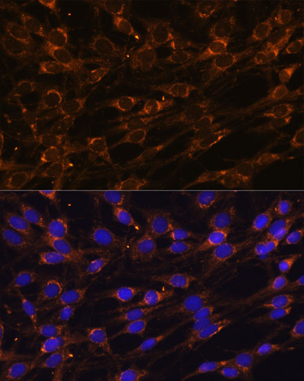 Immunofluorescence analysis of C6 cells using PREPL Polyclonal Antibody  at dilution of 1:100 