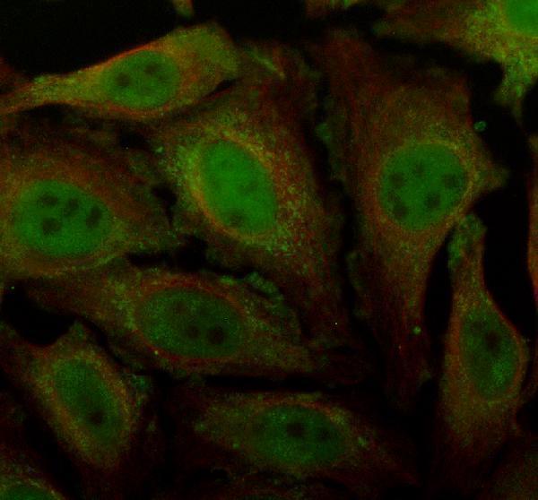 IF analysis of RBM6 using anti-RBM6 antibody (A08776-3) and anti-Alpha Tubulin antibody (M03989-3)