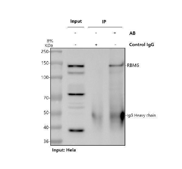 Immunoprecipitating RBM6 in Hela whole cell lysate