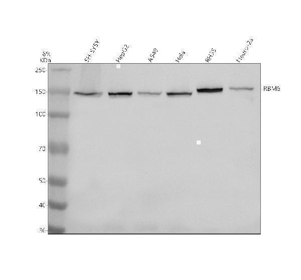 Western blot analysis of RBM6 using anti-RBM6 antibody (A08776-3)