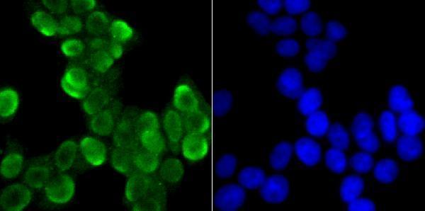 ICC staining U1A in 293T cells (green)