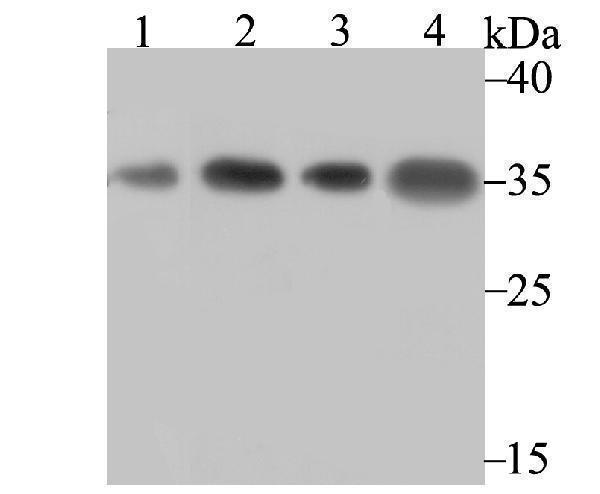 Western blot analysis of U1A on different lysates using anti-U1A antibody at 1/500 dilution